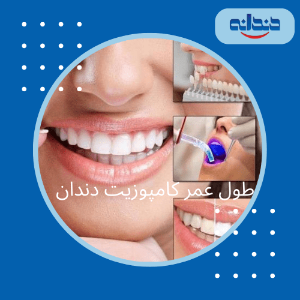 طول عمر کامپوزیت دندان